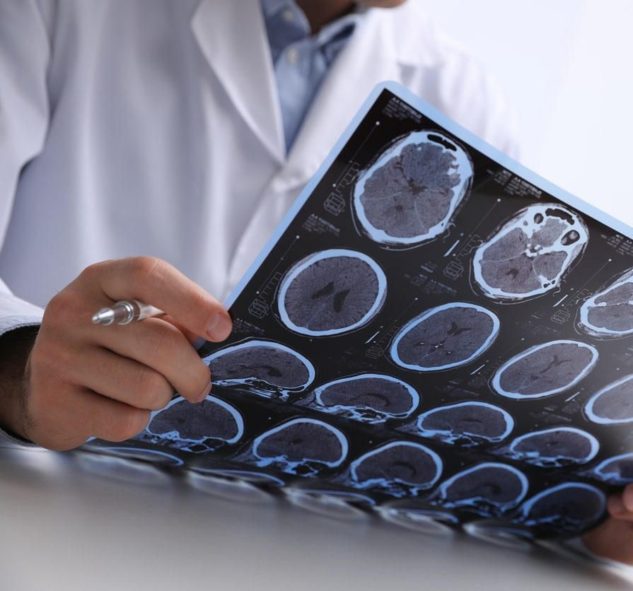 Doctor examining MRI images of patient with multiple sclerosis at table in clinic, closeup